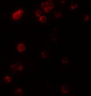 Immunocytochemistry/ Immunofluorescence: KIR2DS2 Antibody - BSA Free [NBP2-82102]