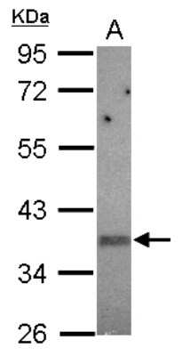 Western Blot: KIR2DS2 Antibody [NBP2-15005]