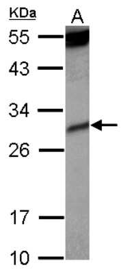 Western Blot: KIR2DS4/CD158i Antibody [NBP2-15006]
