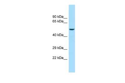Western Blot: KIR5.1 Antibody [NBP3-10361]