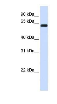 Western Blot: Kirrel2/NEPH3 Antibody [NBP1-59231]