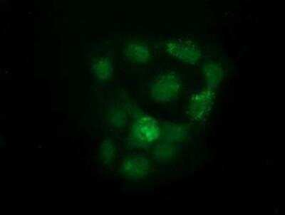 Immunocytochemistry/ Immunofluorescence: KIST Antibody (OTI2H4) [NBP2-03027]