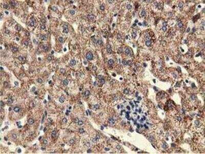 Immunohistochemistry-Paraffin: KIST Antibody (OTI2H4) [NBP2-03027]
