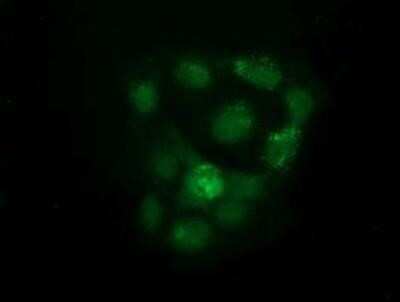 Flow Cytometry: KIST Antibody (OTI2H4) - Azide and BSA Free [NBP2-72383]