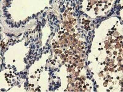 Immunohistochemistry: KIST Antibody (OTI2H4) - Azide and BSA Free [NBP2-72383]