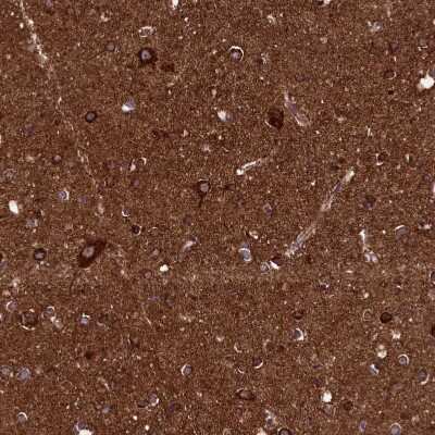 Immunohistochemistry-Paraffin: KLC2 Antibody [NBP1-83722]