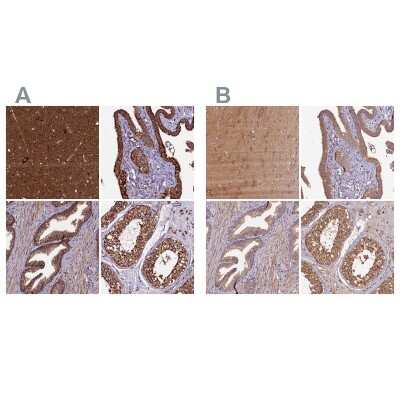 Immunohistochemistry-Paraffin: KLC2 Antibody [NBP1-83722]
