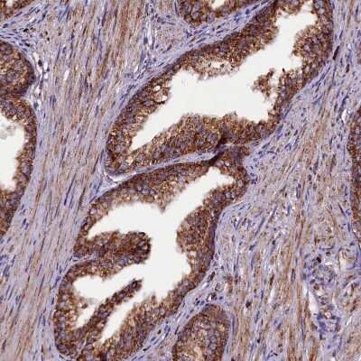 Immunohistochemistry-Paraffin: KLC2 Antibody [NBP1-83722]