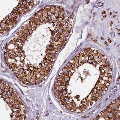 Immunohistochemistry-Paraffin: KLC2 Antibody [NBP1-83722]