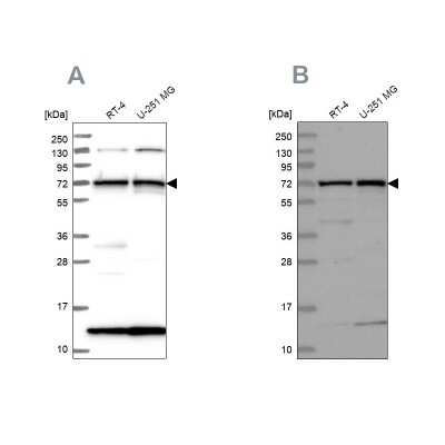 Western Blot: KLC2 Antibody [NBP1-83722]