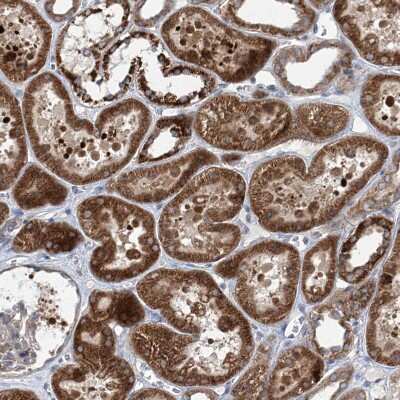 Immunohistochemistry-Paraffin: KLC4 Antibody [NBP1-88772]