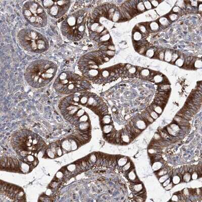 Immunohistochemistry-Paraffin: KLC4 Antibody [NBP1-88772]