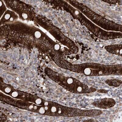 Immunohistochemistry-Paraffin: KLC4 Antibody [NBP1-88773]