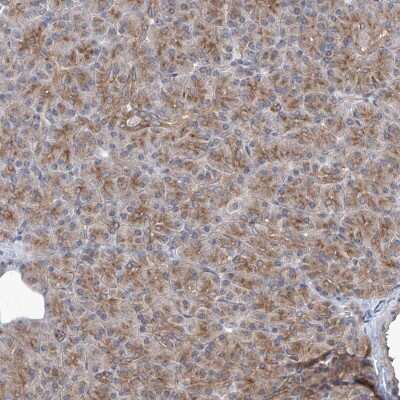Immunohistochemistry-Paraffin: KLC4 Antibody [NBP1-88773]