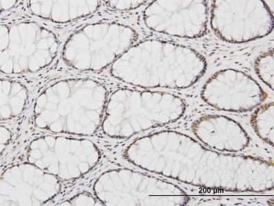 Immunohistochemistry-Paraffin: KLF11 Antibody (10D8) [H00008462-M03]