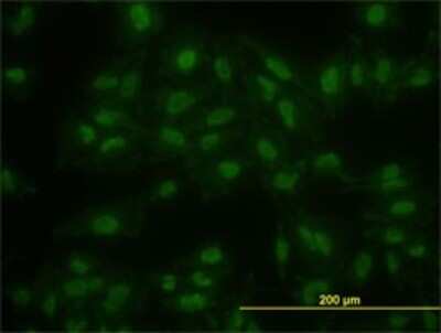 Immunocytochemistry/ Immunofluorescence: KLF11 Antibody (8F4) [H00008462-M01]
