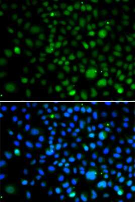 Immunocytochemistry/ Immunofluorescence: KLF15 Antibody - BSA Free [NBP3-04599]