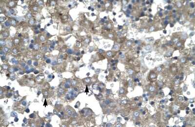 Immunohistochemistry: KLF15 Antibody [NBP2-84120]