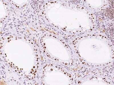 Immunohistochemistry-Paraffin: KLF17 Antibody [NBP2-99355]