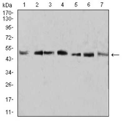 Western Blot: KLF2 Antibody (2F12A11)BSA Free [NBP2-61812]