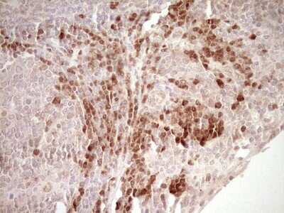 Immunohistochemistry-Paraffin: KLF2 Antibody (OTI3A10) [NBP2-45510]