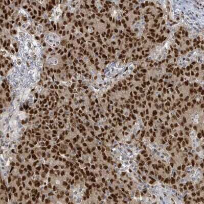 Immunohistochemistry-Paraffin: KLF3 Antibody [NBP2-48937]