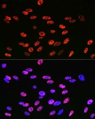 Immunocytochemistry/ Immunofluorescence: KLF4 Antibody (7B7U1) [NBP3-15469]
