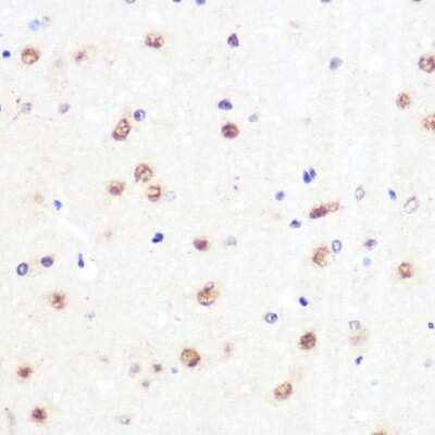 Immunohistochemistry-Paraffin: KLF4 Antibody (7B7U1) [NBP3-15469]