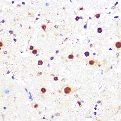 Immunohistochemistry-Paraffin: KLF4 Antibody (7B7U1) [NBP3-15469]