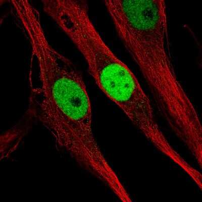 Immunocytochemistry/ Immunofluorescence: KLF4 Antibody (CL5782) [NBP2-61426]