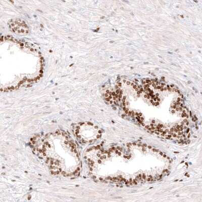 Immunohistochemistry-Paraffin: KLF4 Antibody (CL5782) [NBP2-61426]