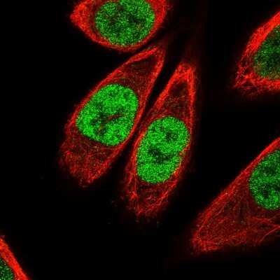 Immunocytochemistry/ Immunofluorescence: KLF4 Antibody (CL5785) [NBP2-61427]