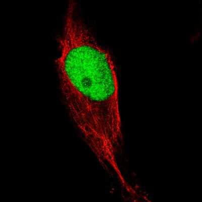 Immunocytochemistry/ Immunofluorescence: KLF4 Antibody (CL5785) [NBP2-61427]