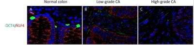 Immunohistochemistry: KLF4 Antibody [NBP2-24749]