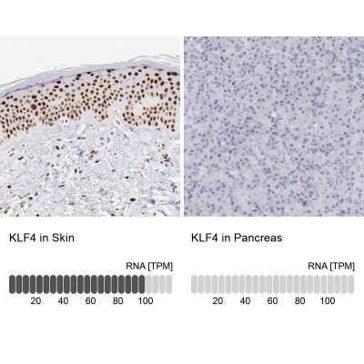 Immunohistochemistry-Paraffin: KLF4 Antibody [NBP1-83940]