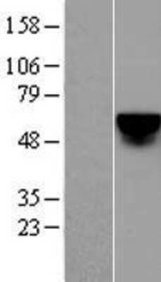 Western Blot: KLF4 Overexpression Lysate [NBL1-12320]