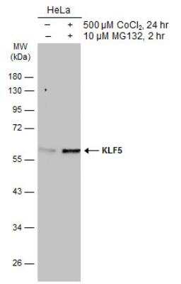 Western Blot: KLF5 Antibody [NBP1-32245]