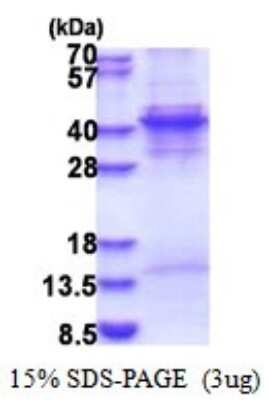 SDS-PAGE: Recombinant Human KLF6 His Protein [NBP2-51565]