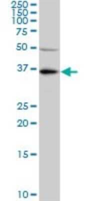 Western Blot: KLF7 Antibody (3E8-B8) [H00008609-M01]