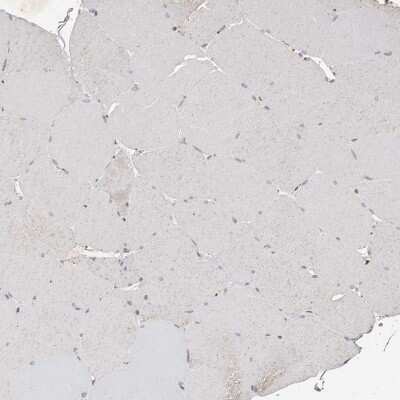 Immunohistochemistry-Paraffin: KLF7 Antibody [NBP1-80638]