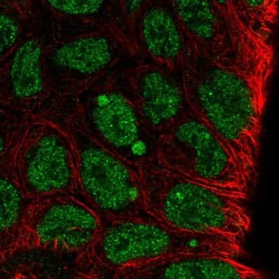 Immunocytochemistry/ Immunofluorescence: KLF8 Antibody [NBP2-57740]