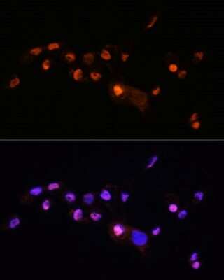Immunocytochemistry/ Immunofluorescence: KLF8 Antibody - Azide and BSA Free [NBP3-04846]