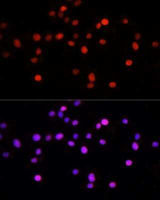 Immunocytochemistry/ Immunofluorescence: KLF8 Antibody - Azide and BSA Free [NBP3-04846]
