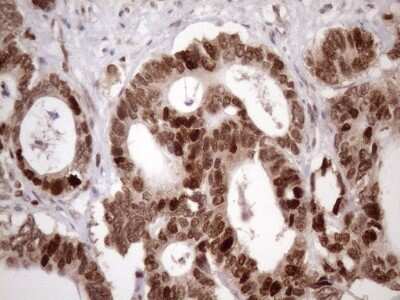 Immunohistochemistry: KLF9 Antibody (OTI8A11) [NBP2-45511]