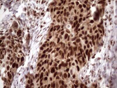 Immunohistochemistry: KLF9 Antibody (OTI8A11) [NBP2-45511]