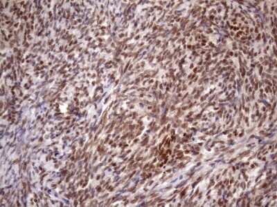 Immunohistochemistry: KLF9 Antibody (OTI8A11) [NBP2-45511]