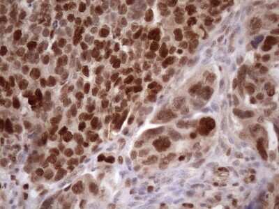 Immunohistochemistry: KLF9 Antibody (OTI8A11) [NBP2-45511]