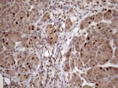 Immunohistochemistry: KLF9 Antibody (OTI8A11) [NBP2-45511]