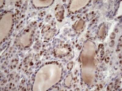 Immunohistochemistry: KLF9 Antibody (OTI8A11) [NBP2-45511]