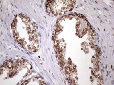 Immunohistochemistry: KLF9 Antibody (OTI8A11) [NBP2-45511]